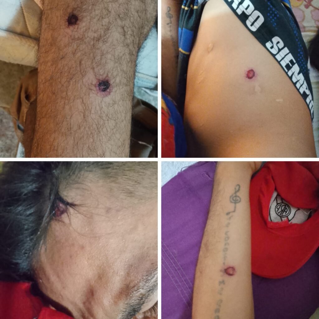 El hermano del joven golpeado, con heridas de balas de goma